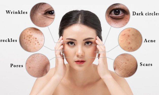 Kondisi Kecerahan Kulit Bisa Di Pengaruhi Beberapa Hal