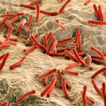 Keberadaan Mikroorganisme Kecil Yang Berbahaya Yaitu Virus